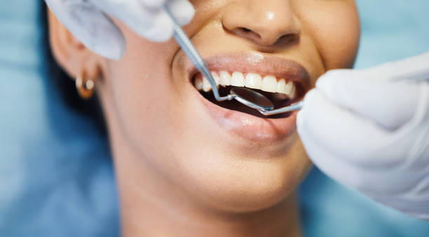 Best Emergency Wisdom Teeth Removal in Perry Hall, MD